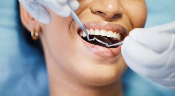 Best Emergency Dental Care for Broken or Chipped Teeth in Heidelberg, TX